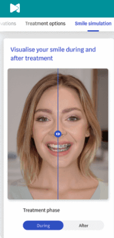 a phone with the dental monitoring app open showing a patient with braces