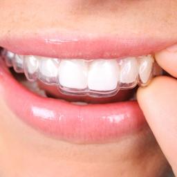Close up on Invisalign clear aligners fitting to upper teeth